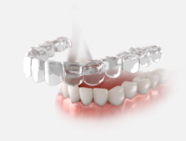 clear aligners near you