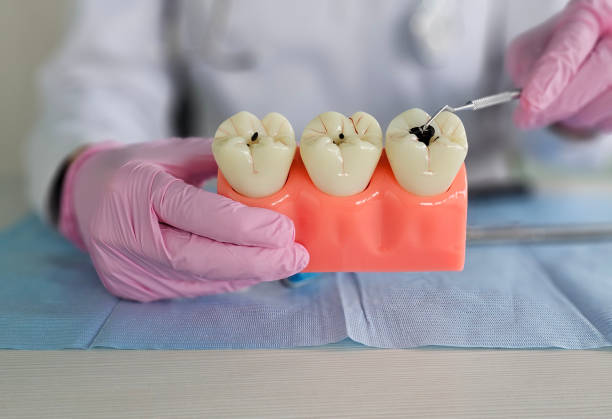 tooth extractions near you