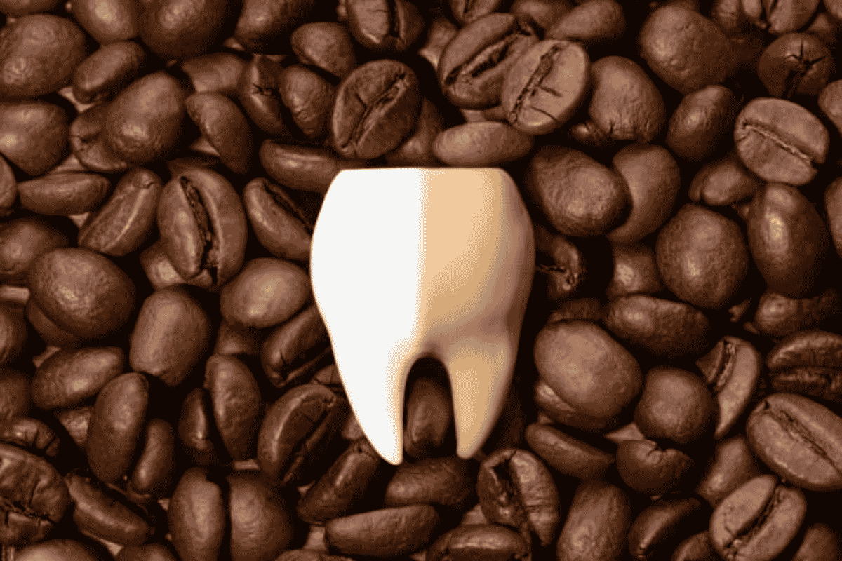 teeth-whitening-for-coffee-stains